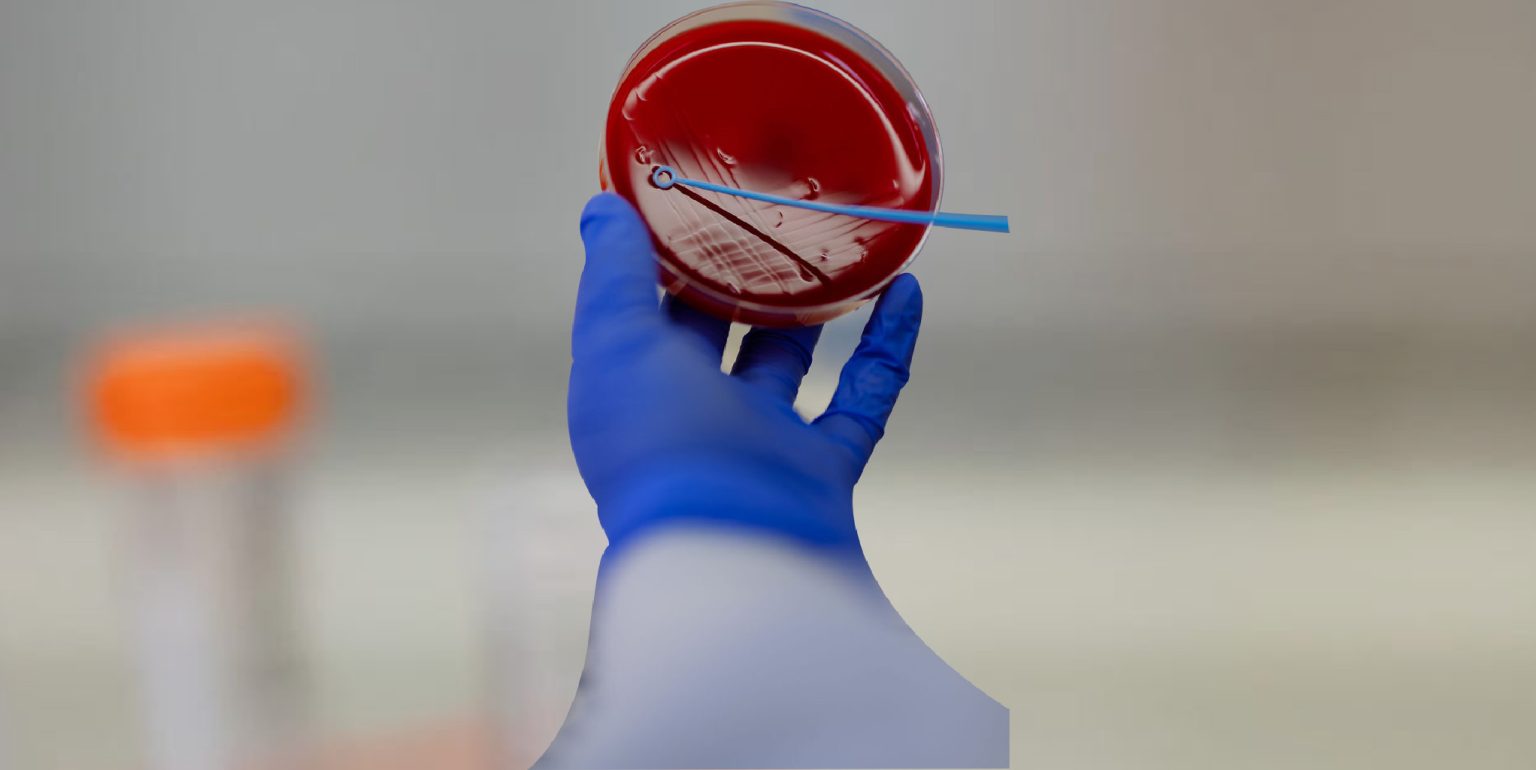 Microbiological | Pathogenia
